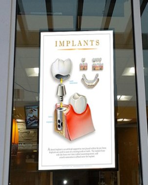 High_Bright_WindowPoster_dentist2