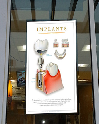 High_Bright_WindowPoster_dentist2